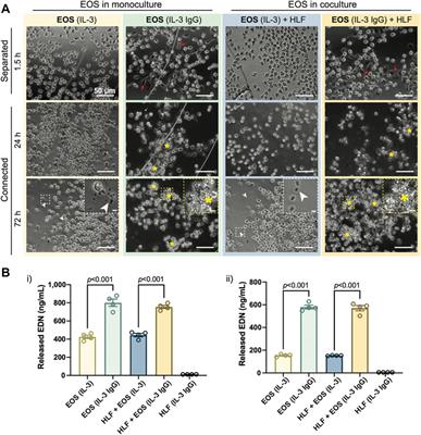 An open microfluidic coculture model of fibroblasts and eosinophils to investigate mechanisms of airway inflammation